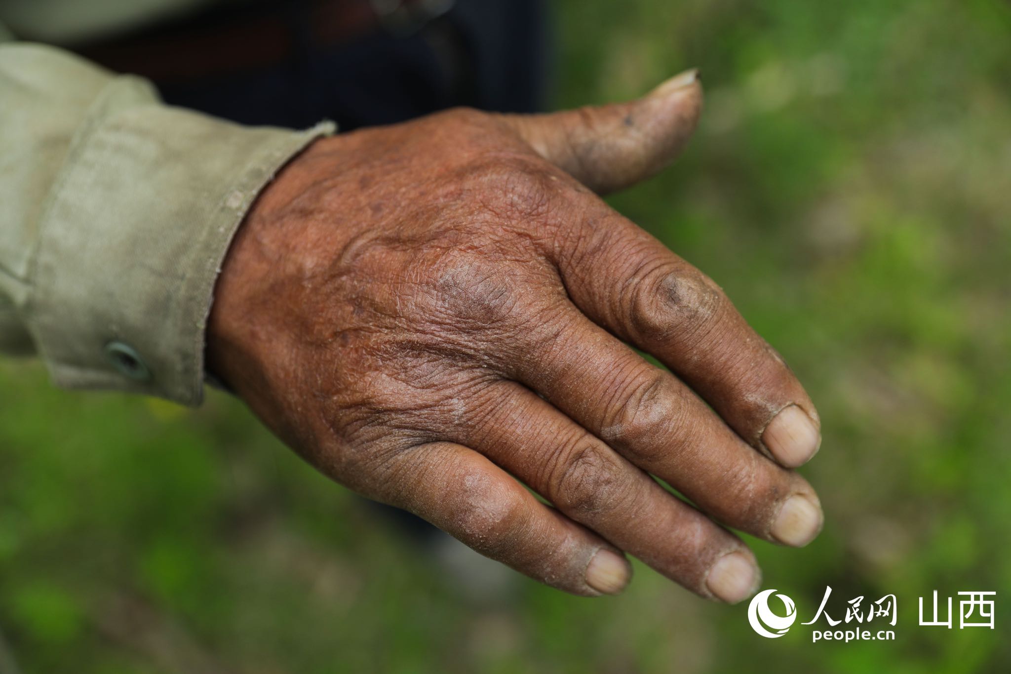 王占峰的手。人民網記者 王帆攝